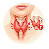 Hyper Thyroid Problem