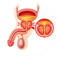 Urine Problem